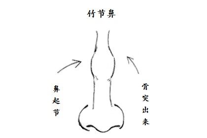 竹节鼻面相图片