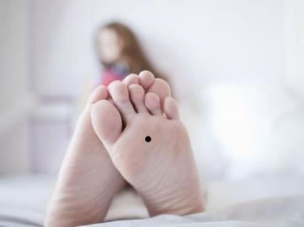 女人脚底板有痣代表什么，快来看！